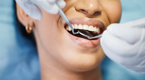 Best Emergency Dental Care for Broken or Chipped Teeth in Barrackville, WV